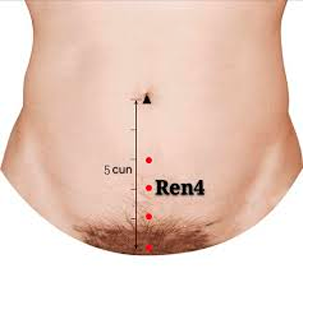 Punto Guan Yuan Ren 4 para la nutrición de la esencia vital